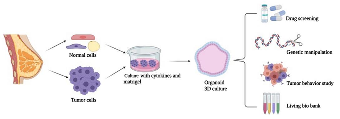 Establishment workflow of Breast Cancer Organoids