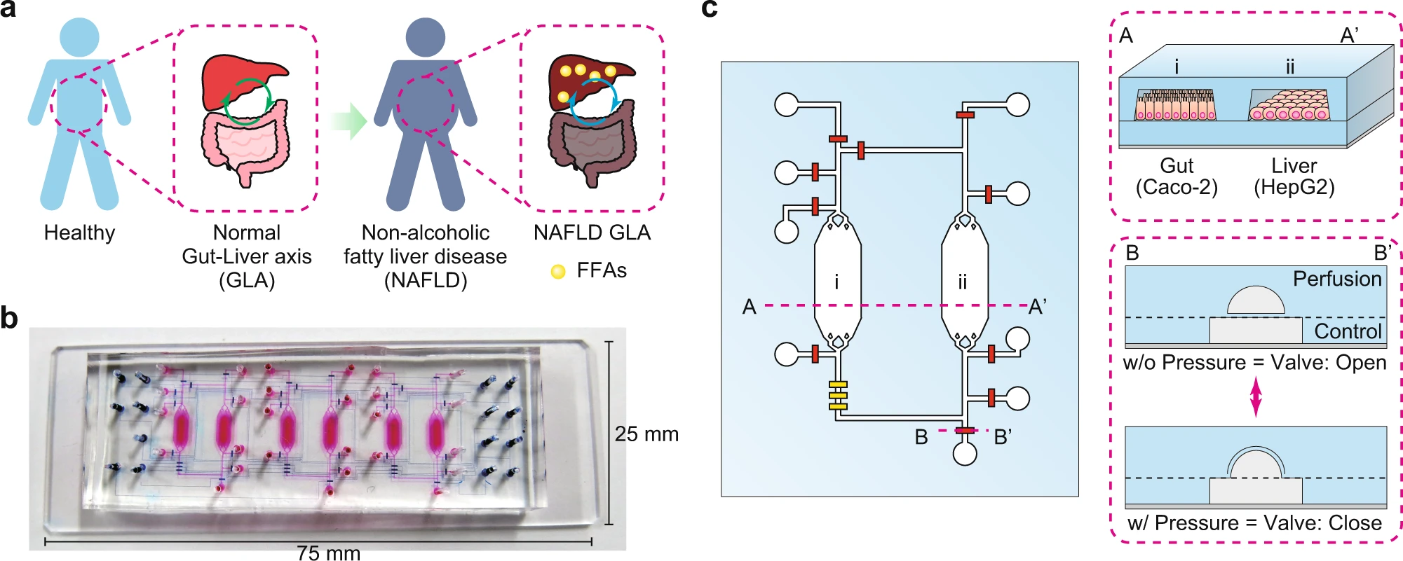 Design of the integrated-gut-liver-on-a-chip (iGLC) platform to recapitulate NAFLD.
