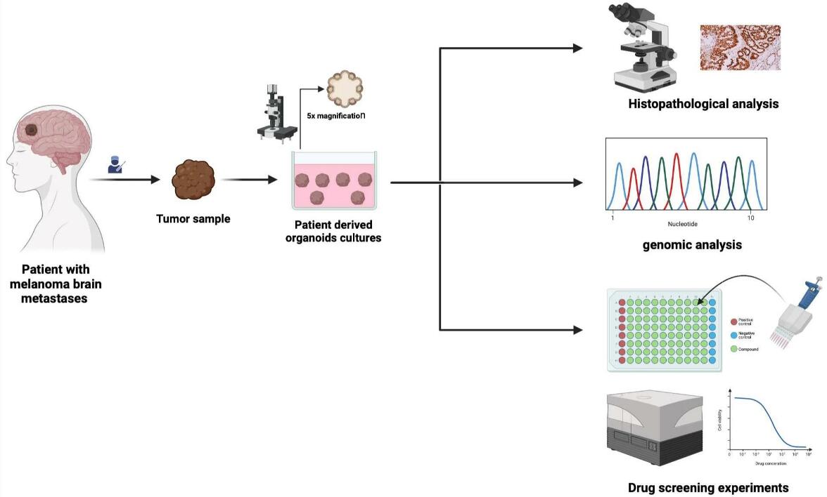 Establishment and application workflow of melanoma organoids