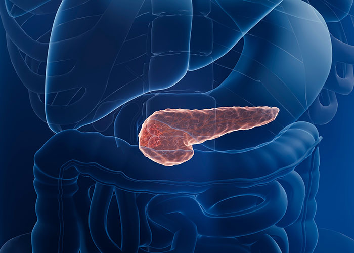 Pancreatic Cancer Organoids