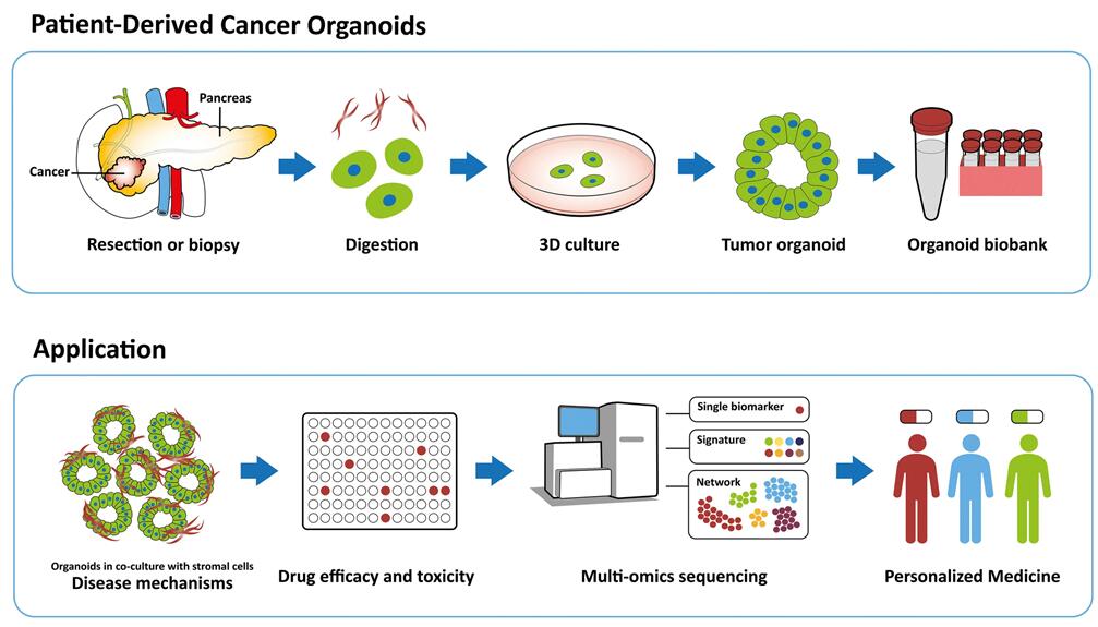 Establishment and application workflow of pancreatic cancer organoids