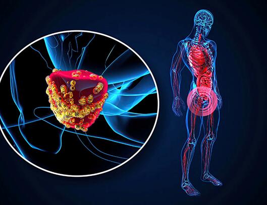 Prostate Cancer Organoids Morphology